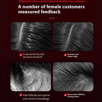 Glowix Light Therapy Scalp Massager for Hair Loss & Oil Applicator